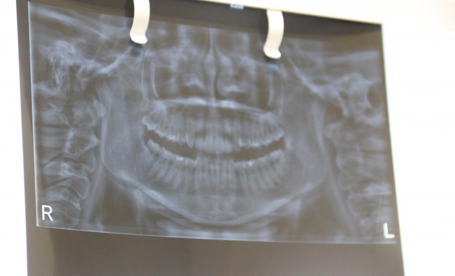 Campanha aborda importância do prontuário odontológico para identificação humana